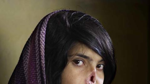 Jodi Bieber wins the World Press Photo of the Year 2010 with this picture of Bibi Aisha, an 18-year-old woman from Oruzgan province in Afghanistan, who fled back to her family home from her husband's house, complaining of violent treatment. The Taliban arrived one night, demanding Bibi be handed over to face justice. After a Taliban commander pronounced his verdict, Bibi's brother-in-law held her down and her husband sliced off her ears and then cut off her nose.
