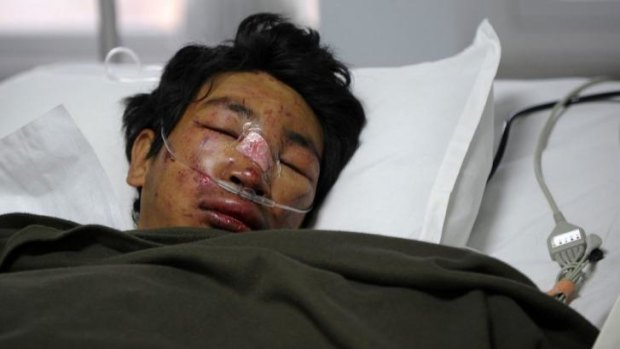 Survivor: Nepalese mountaineer Dawa Tashi Sherpa lies in the Intensive Care Unit at Grande International Hospital in Kathmandu.