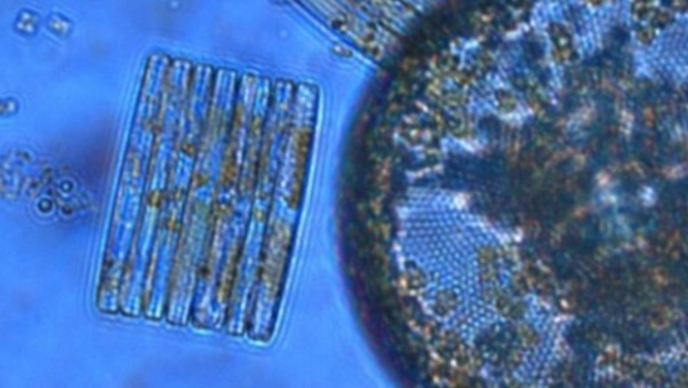 Phytoplankton like these diatoms turn out to be  sensitive to ocean acidification, according to new research.