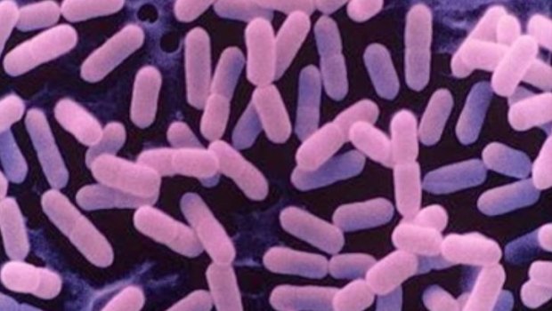 Listeria bacteria.