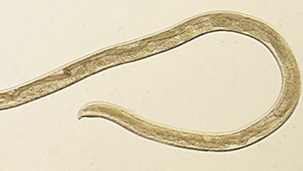 Thelazia gulosa, a type of eye worm seen in cattle in the northern United States and southern Canada, but never before in humans before.