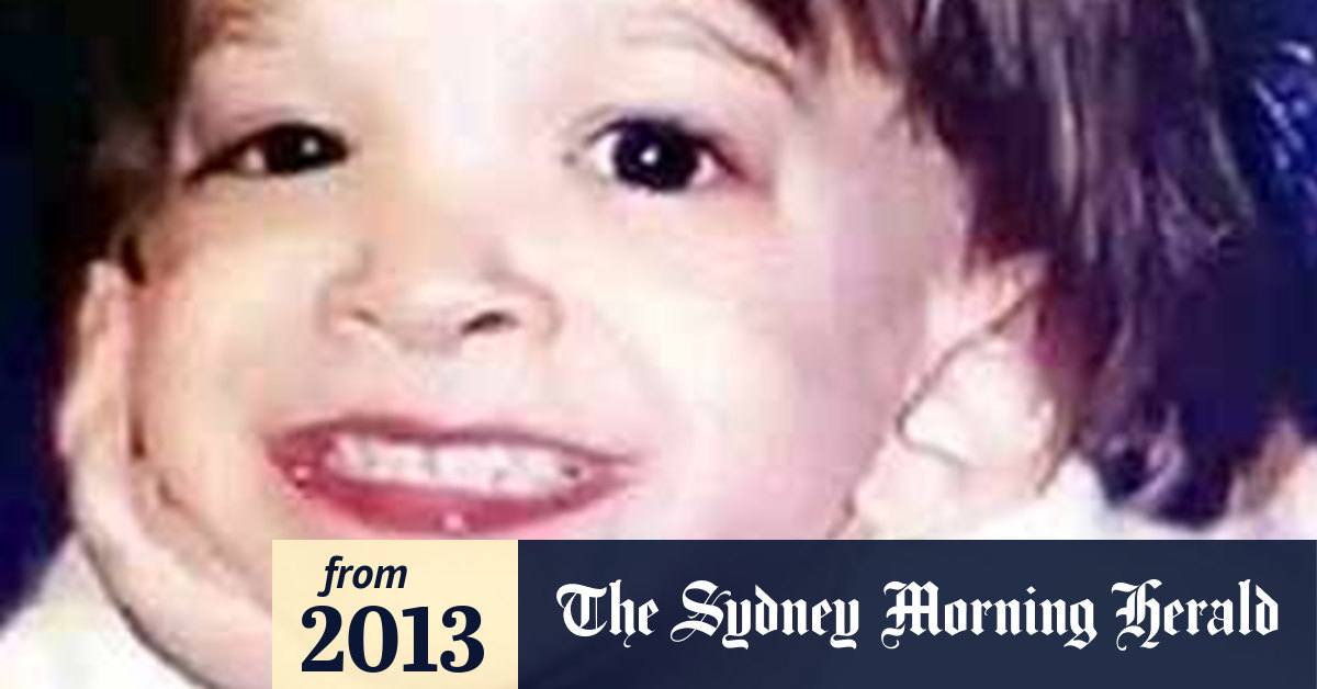 Syndrome X Brooke Greenberg Dies Aged 20 But Still A Toddler