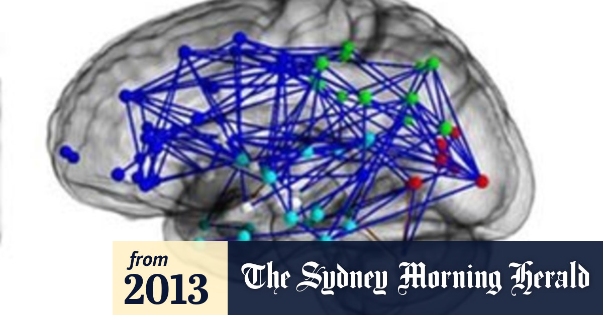 Male and female brains show significant differences