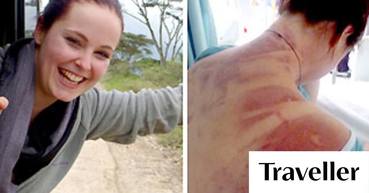 Woman injured after bungy cord broke warns travellers on insurance