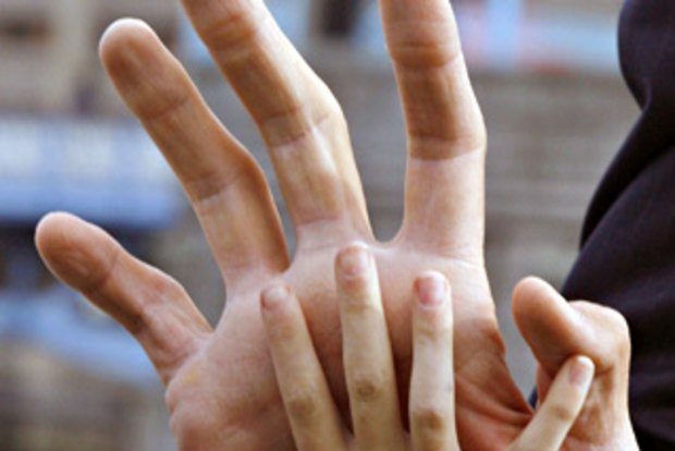 size finger q cancer length prostate predicts study risk: Finger