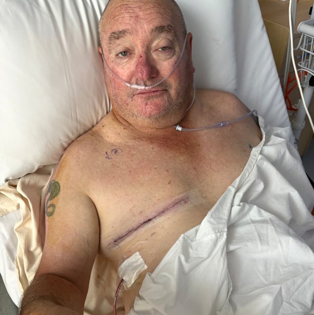 Male breast cancer sufferer Phil Smith.