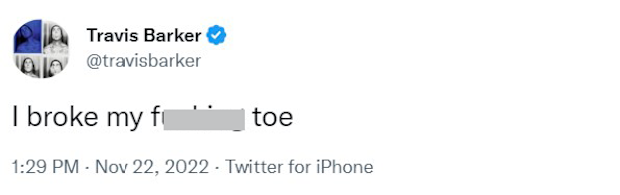 Travis Barker reveals he broke his toe days.
