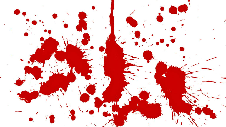 The real CSI: Finding answers in blood-spatter patterns