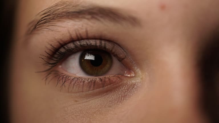 Why do we get dark circles under our eyes 