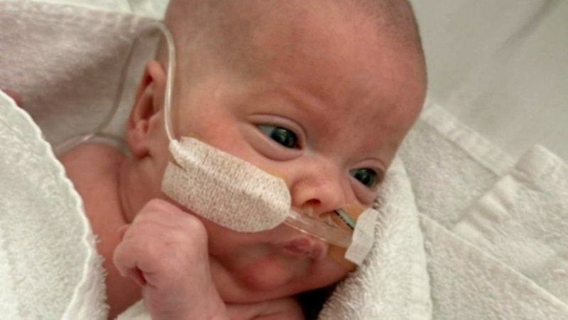 Video: Australia’s youngest-ever premature baby