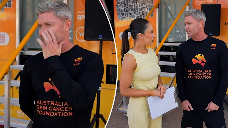 Michael Clarke reveals skin cancer cut from face