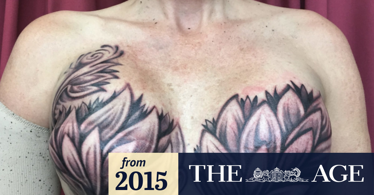 Breast-cancer survivor covers mastectomy scars with breast tattoo
