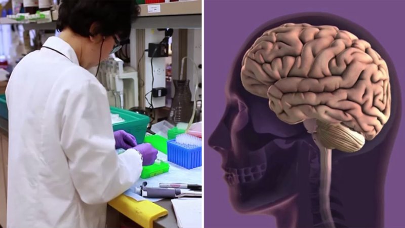 Alzheimer'la mücadelede yeni ilaç sevinçle karşılandı