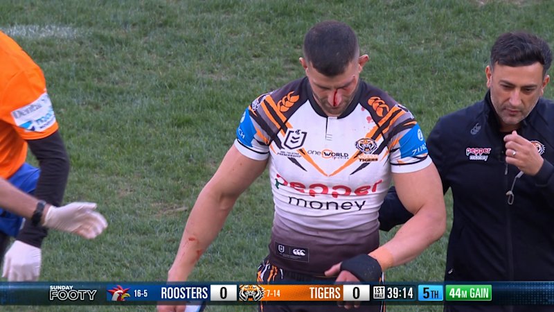 Alex Twal cuts himself open and throws mouthguard after concussion incident