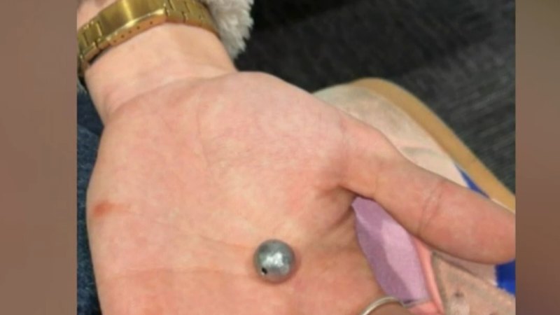 Brisbane slingshot attack charges