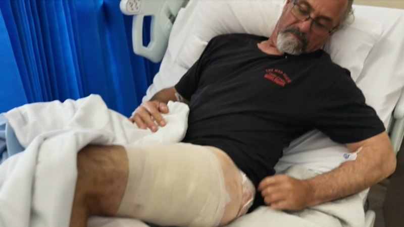 Surfer who survived shark attack relives dramatic encounter