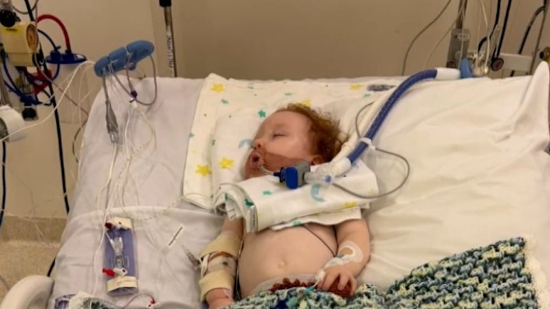 Toddler in coma after inhaling cake-decorating dust