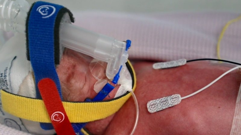 Queensland mum gives birth to quadruplets
