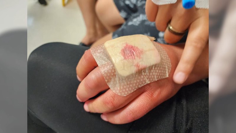 Alleged hospital blunder leaves child badly hurt