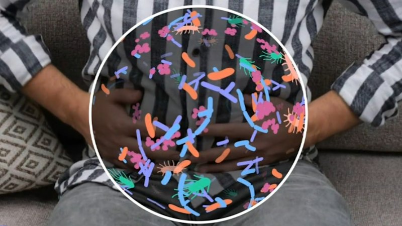 Researchers study link between gut microbiome and of bowel cancer