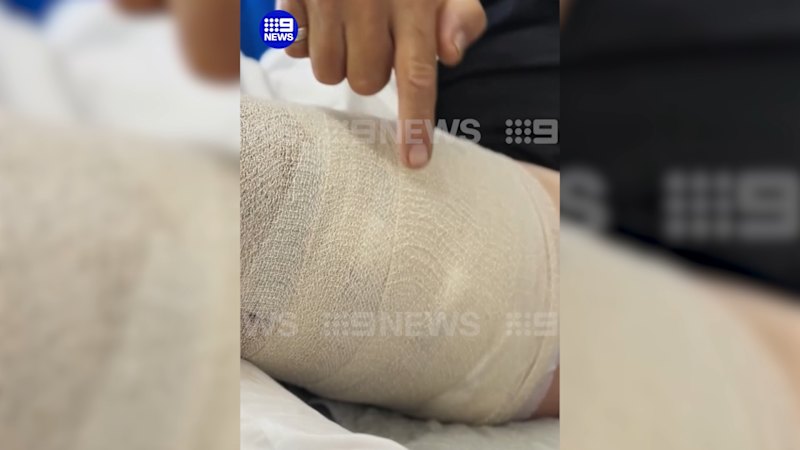 Surfer describes moment he was attacked by a shark