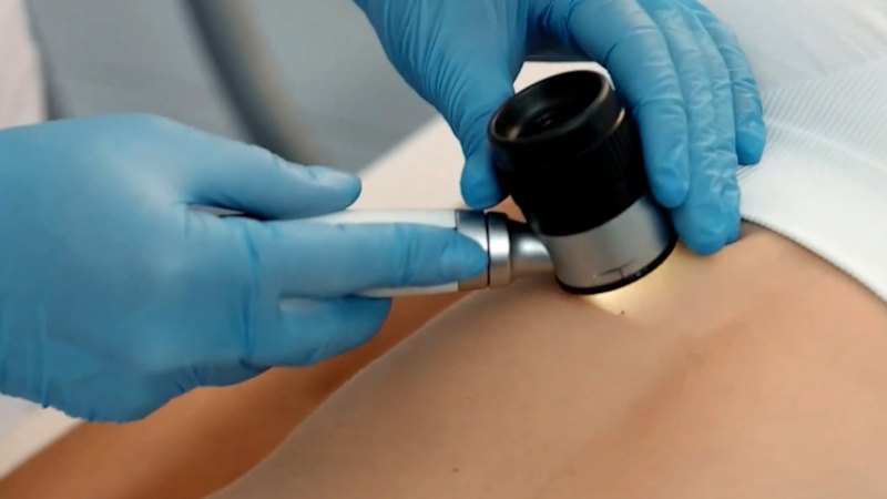 Video: Free Online Tool Could Save Lives From Cancer