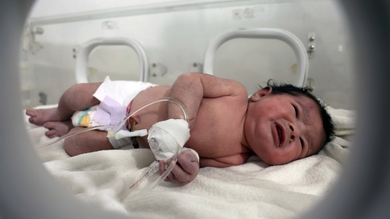 Suriye'de deprem enkazı altında dünyaya gelen kız bebeğin sağlık durumu iyi