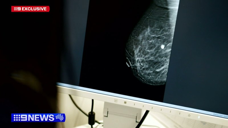 Australian researchers identify potential new treatment approach for triple-negative breast cancer