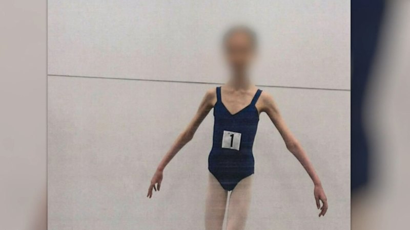 Parents accused of starving daughter may not face retrial after convictions quashed