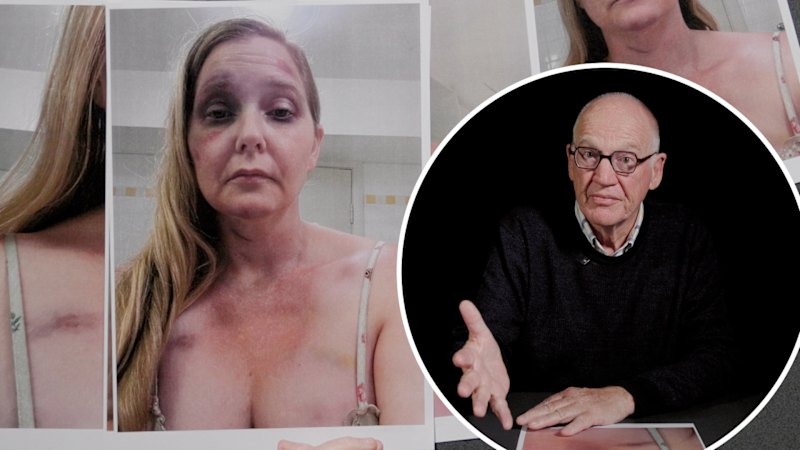 Forensic expert David Wells reviews photos of Virginia Giuffre’s bruises in assault trial