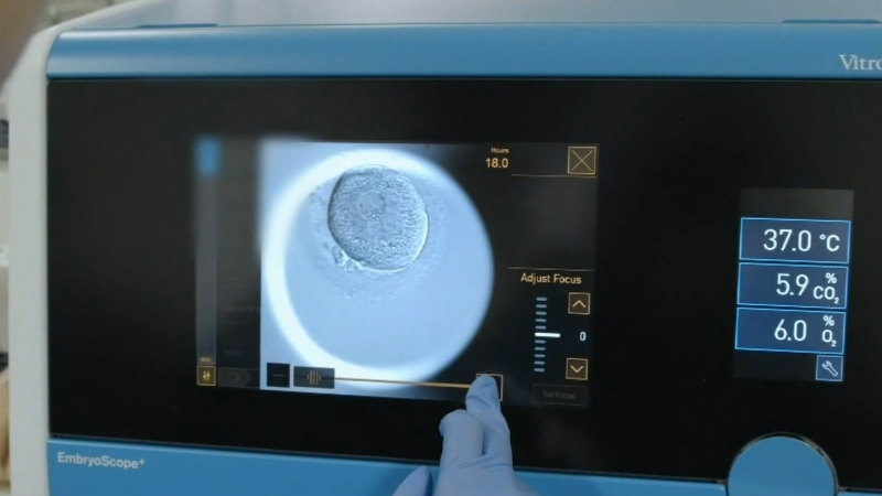 IVF rebate scheme massively scaled back