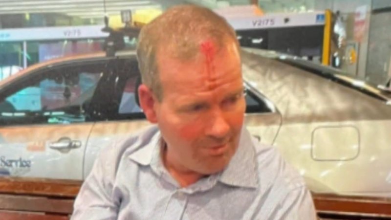 Queensland man appeals to find attackers after coward punch