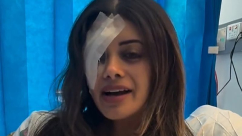 Critical incident after ex-Greens candidate injured at protest