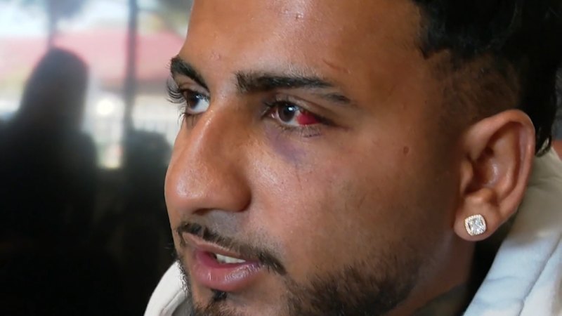 Man opens up about vicious Adelaide assault