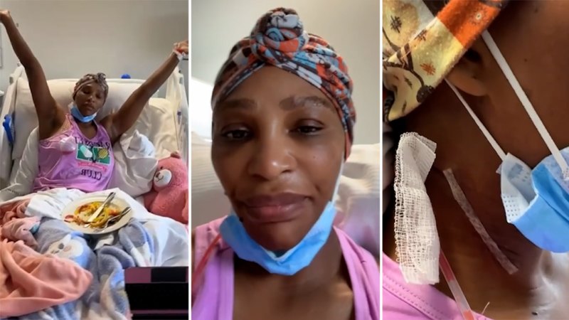 Serena Williams reveals she had cyst removed from her neck