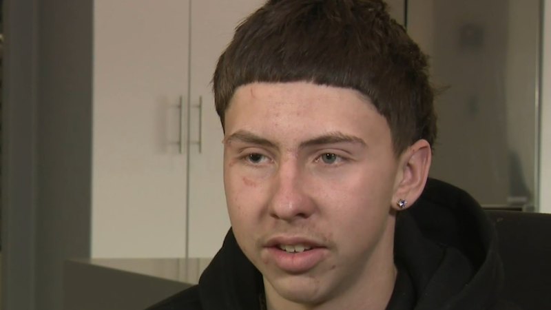 Emergency surgery for teen glassed through car window