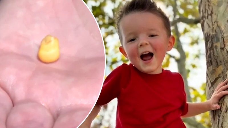 Corn kernel pit leads to two-year-old needing lung surgery