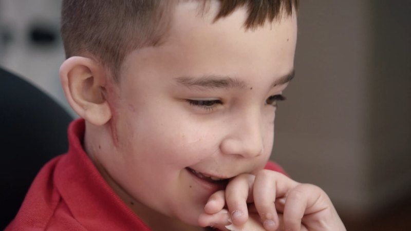 Easton gets emotional as he sees his new ears for the first time