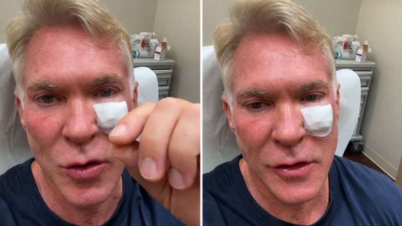 Good Morning America’s Sam Champion undergoes skin cancer surgery