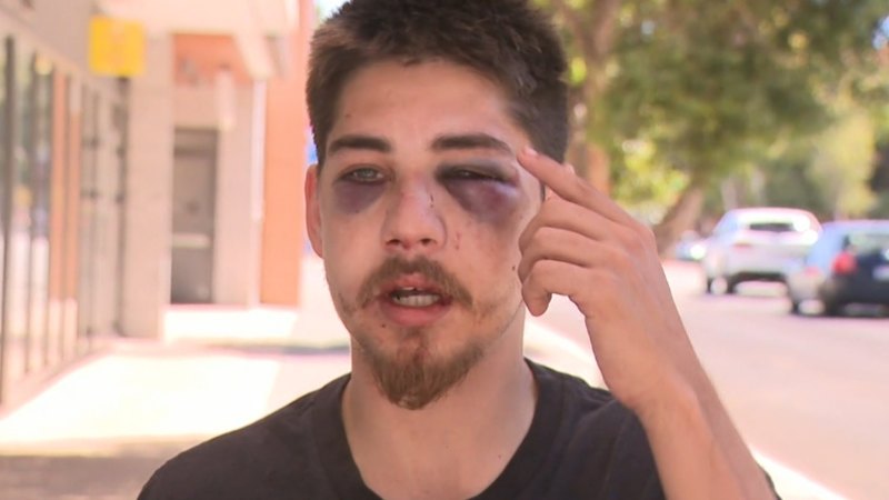 Perth father left with broken jaw after brutal attack