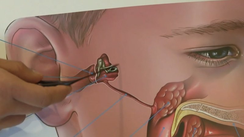 Program gives Indigenous kids free life-changing surgery