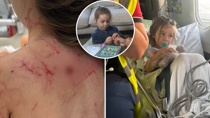 Four-year-old attacked by dog at WA beach