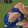 Western Bulldogs star Tom Liberatore received a heavy shoulder to the head in the opening minutes against Hawthorn, before copping a stray boot to the face late in the final quarter. Credit: Fox Footy