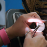 Physician assistant works hard to remove a fake nail from her patient's ear