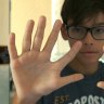 Meet the De Silvas, a 14-strong family from Brazil that have six fingers and six toes