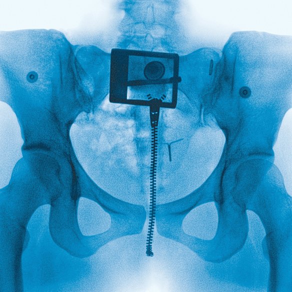 The album cover for Virgin is an X-ray of Lorde’s pelvis that shows a zipper, belt-buckle, and an IUD floating in ice blue.