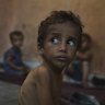 Yazan Abu Ful, a 2-year-old malnourished child, sits at his family home in the Shati refugee camp in Gaza City on July 23, 2025.