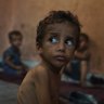 Yazan Abu Ful, a two-year-old malnourished child, sits at his family home in the Shati refugee camp in Gaza City on Wednesday.