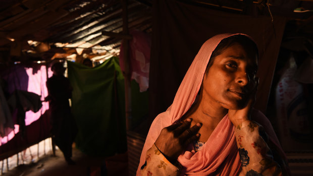 Almas Khatun, 40, from Tula Toli village in Myanmar reveals the scars where her throat and face were cut by the Myanmar military and monks. Her husband and 7 children were killed in the attack on their village. 