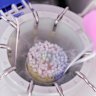 Egg freezing at Number One Fertility clinic in Melbourne.